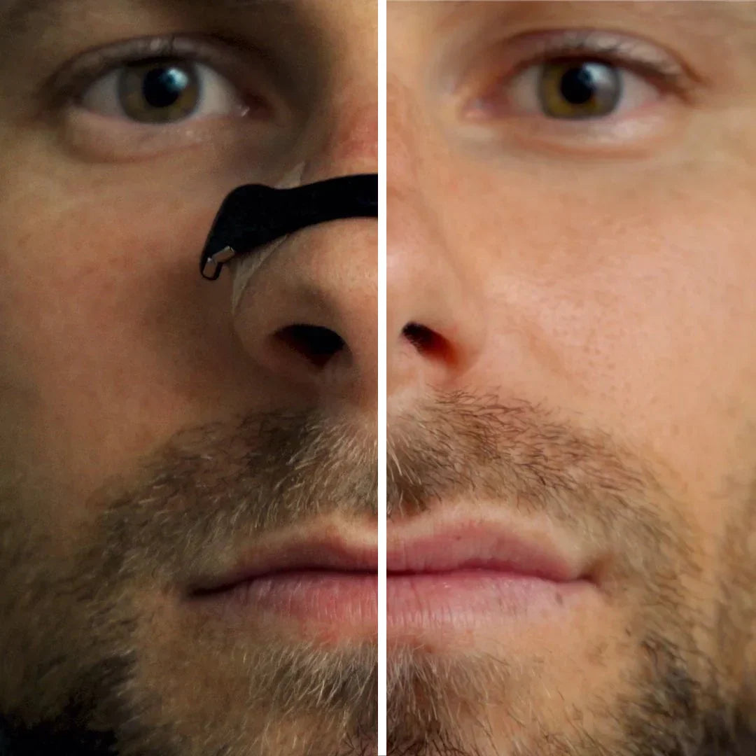 Magnetic Nasal Band