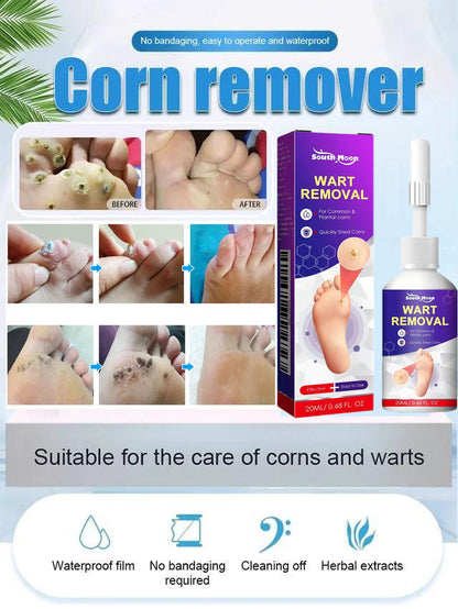 【Apply and peel】Corn remover