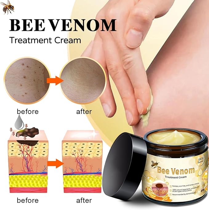 Bee Venom Skin Treatment Cream