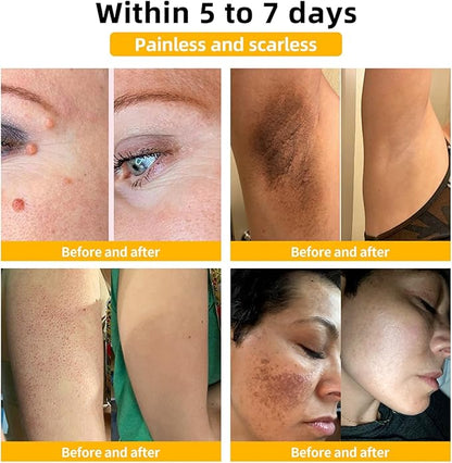 Bee Venom Skin Treatment Cream